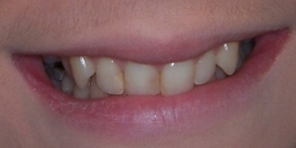 case_0_image_17.jpg"