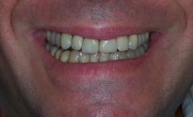 case_0_image_50.jpg"