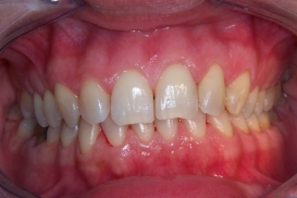 case_0_image_15.jpg"