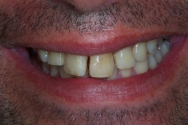 case_0_image_16.jpg"