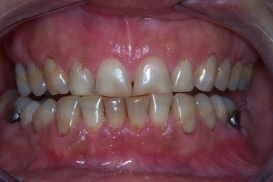 case_0_image_18.jpg"