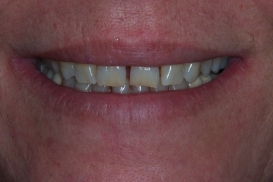 case_0_image_19.jpg"