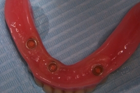 case_0_image_23.jpg"