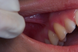 case_0_image_24.jpg"