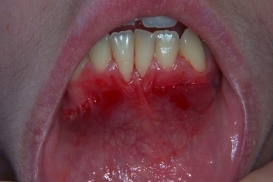 case_0_image_25.JPG"