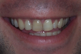 case_0_image_26.jpg"