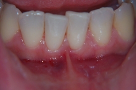 case_0_image_28.jpg"