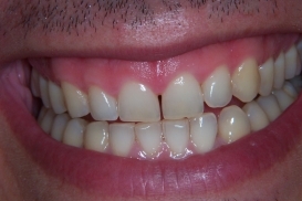 case_0_image_31.jpg"