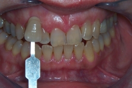 case_0_image_33.jpg"