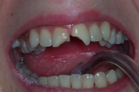 case_0_image_36.jpg"