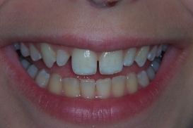 case_0_image_37.jpg"