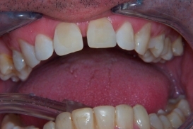 case_0_image_38.jpg"