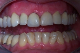 case_0_image_39.jpg"