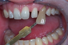 case_0_image_41.jpg"