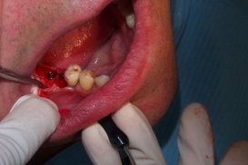 case_0_image_43.jpg"