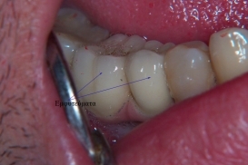 case_0_image_44.jpg"