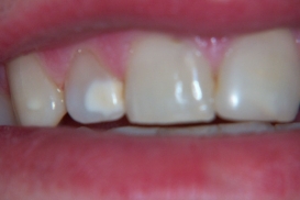 case_0_image_45.jpg"