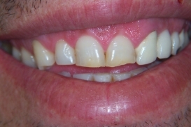 case_0_image_46.jpg"