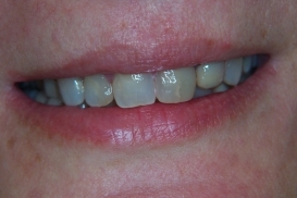 case_0_image_47.jpg"