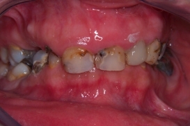 case_0_image_48.jpg"