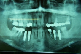 case_0_image_49.jpg"