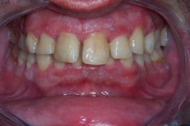 case_0_image_51.jpg"