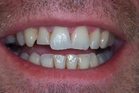 case_0_image_52.jpg"