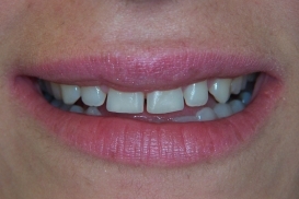 case_0_image_53.jpg"