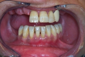 case_0_image_54.jpg"