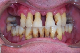case_0_image_55.jpg"