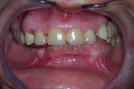 case_0_image_56.jpg"