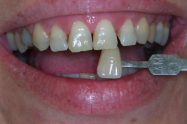 case_0_image_57.jpg"