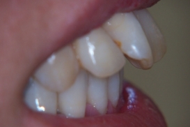 case_0_image_59.jpg"