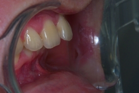 case_0_image_60.jpg"