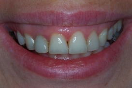 case_0_image_61.jpg"