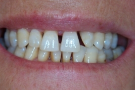 case_0_image_62.jpg"