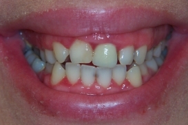 case_0_image_63.jpg"