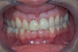case_0_image_64.jpg"