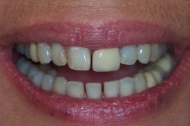 case_0_image_65.jpg"
