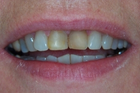 case_0_image_66.jpg"