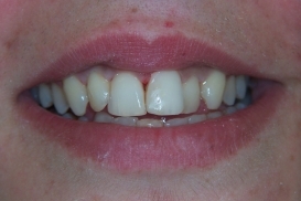 case_0_image_67.jpg"