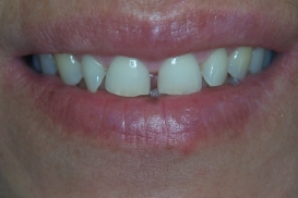 case_0_image_68.jpg"