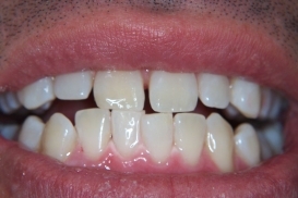 case_0_image_69.jpg"