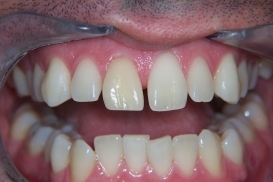 case_0_image_70.jpg"