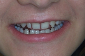 case_0_image_71.jpg"