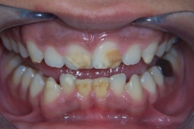 case_0_image_72.jpg"