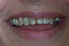 case_0_image_75.jpg"