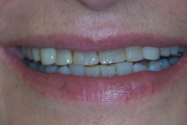 case_0_image_77.jpg"