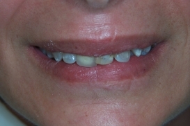 case_0_image_78.jpg"