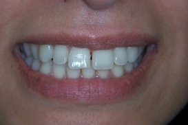 case_0_image_79.jpg"